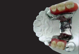 HÀM KHUNG + RĂNG ACRYLIC TRÊN NỀN MẪU TRẮNG